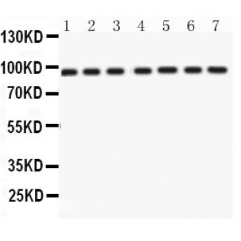 NBN / Nibrin Antibody - p95 NBS1 antibody Western blot. All lanes: Anti p95 NBS1 at 0.5 ug/ml. Lane 1: Rat Testis Tissue Lysate at 50 ug. Lane 2: Rat Brain Tissue Lysate at 50 ug. Lane 3: Rat Liver Tissue Lysate at 50 ug. Lane 4: Mouse Testis Tissue Lysate at 50 ug. Lane 5: HELA Whole Cell Lysate at 40 ug. Lane 6: A431 Whole Cell Lysate at 40 ug. Lane 7: HUT Whole Cell Lysate at 40 ug. Predicted band size: 95 kD. Observed band size: 95 kD.