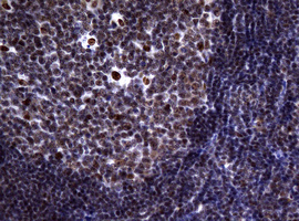 NBN / Nibrin Antibody - IHC of paraffin-embedded Human tonsil using anti-NBN mouse monoclonal antibody.