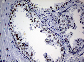 NBN / Nibrin Antibody - IHC of paraffin-embedded Human prostate tissue using anti-NBN mouse monoclonal antibody.