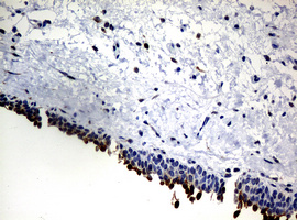 NBN / Nibrin Antibody - IHC of paraffin-embedded Human bladder tissue using anti-NBN mouse monoclonal antibody.