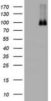 NBN / Nibrin Antibody - HEK293T cells were transfected with the pCMV6-ENTRY control (Left lane) or pCMV6-ENTRY NBN (Right lane) cDNA for 48 hrs and lysed. Equivalent amounts of cell lysates (5 ug per lane) were separated by SDS-PAGE and immunoblotted with anti-NBN.