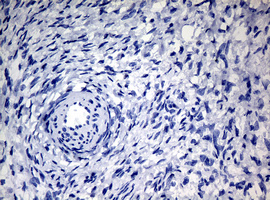 NBN / Nibrin Antibody - IHC of paraffin-embedded Human Ovary tissue using anti-NBN mouse monoclonal antibody.