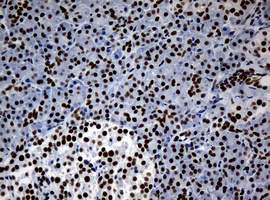 NBN / Nibrin Antibody - IHC of paraffin-embedded Human pancreas tissue using anti-NBN mouse monoclonal antibody.