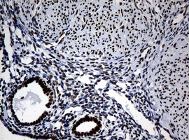 NBN / Nibrin Antibody - IHC of paraffin-embedded Human endometrium tissue using anti-NBN mouse monoclonal antibody.