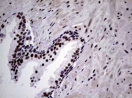 NBN / Nibrin Antibody - IHC of paraffin-embedded Human prostate tissue using anti-NBN mouse monoclonal antibody.