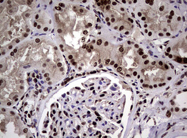 NBN / Nibrin Antibody - IHC of paraffin-embedded Human Kidney tissue using anti-NBN mouse monoclonal antibody.