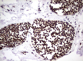 NBN / Nibrin Antibody - IHC of paraffin-embedded Human lymph node tissue using anti-NBN mouse monoclonal antibody.