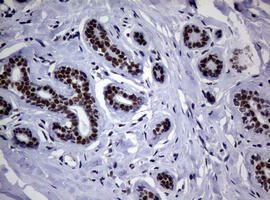 NBN / Nibrin Antibody - IHC of paraffin-embedded Human breast tissue using anti-NBN mouse monoclonal antibody.
