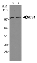 NBN / Nibrin Antibody - NBS1 Antibody - Western Blot on NIH/3T3 (Lane 6) and HeLa whole cell extract (Lane 7).  This image was taken for the unconjugated form of this product. Other forms have not been tested.