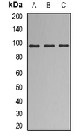 NBN / Nibrin Antibody - Western blot analysis of Nibrin expression in HEK293T (A); A549 (B); Jurkat (C) whole cell lysates.