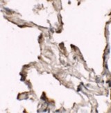 NBN / Nibrin Antibody - Immunohistochemistry of NIBRIN (CT) in human lung tissue with NIBRIN (CT) antibody at 2.5 ug/ml.