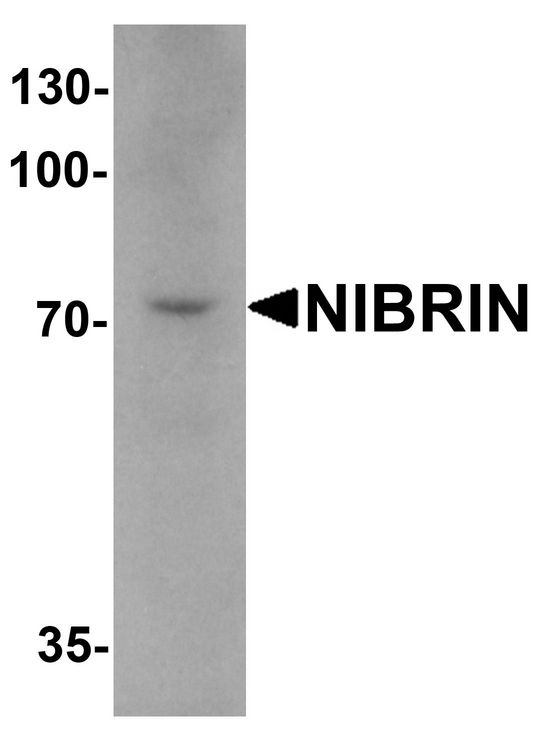 NBN / Nibrin Antibody - Western blot analysis of NIBRIN in mouse lung tissue lysate with NIBRIN antibody at 1 ug/ml.