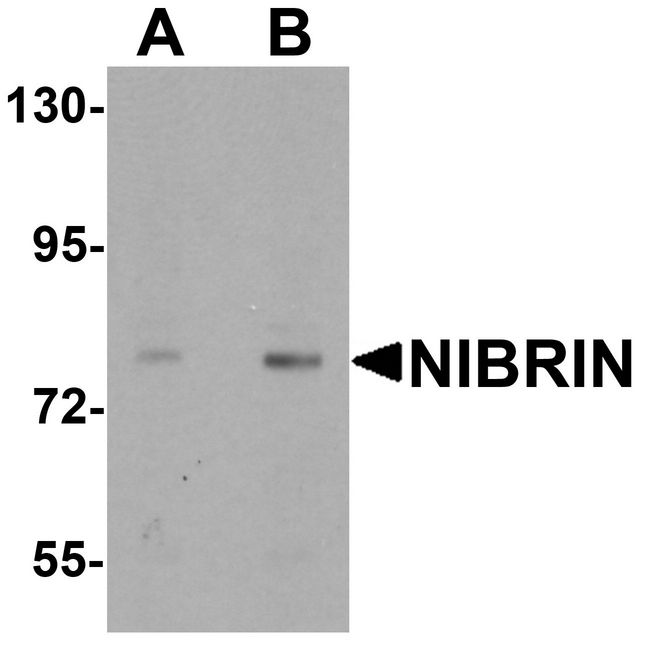 NBN / Nibrin Antibody - Western blot analysis of NIBRIN in rat lung tissue lysate with NIBRIN antibody at (A) 1 and (B) 2 ug/ml.
