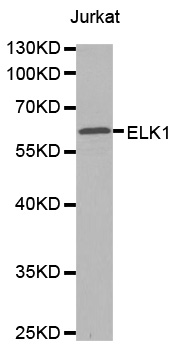 NBN / Nibrin Antibody - Western blot analysis of extracts of Jurkat cells tissue, using ELK1 antibody.
