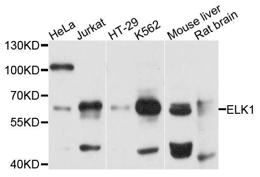 NBN / Nibrin Antibody - Western blot analysis of extracts of various cell lines, using ELK1 antibody at 1:1000 dilution. The secondary antibody used was an HRP Goat Anti-Rabbit IgG (H+L) at 1:10000 dilution. Lysates were loaded 25ug per lane and 3% nonfat dry milk in TBST was used for blocking. An ECL Kit was used for detection and the exposure time was 3s.