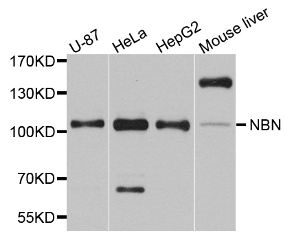 NBN / Nibrin Antibody - Western blot analysis of extracts of various cells.