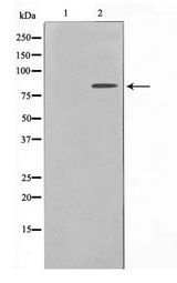NBN / Nibrin Antibody - Western blot of HUVEC cell lysate using Nibrin Antibody