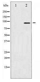 NBN / Nibrin Antibody - Western blot of p95/NBS1 expression in Jurkat whole cell lysates,The lane on the left is treated with the antigen-specific peptide.