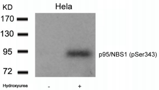 NBN / Nibrin Antibody - Detection of p95/NBS1 (phospho-Ser343) in extracts of HeLa cells untreated or treated with hydroxyurea.
