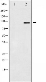 NBN / Nibrin Antibody - Western blot analysis of p95/NBS1 expression in Jurkat whole cells lysates. The lane on the left is treated with the antigen-specific peptide.
