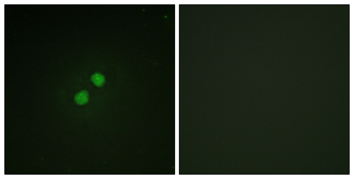 NBN / Nibrin Antibody - Immunofluorescence analysis of NIH/3T3 cells, using Nibrin (Phospho-Ser278) Antibody. The picture on the right is blocked with the phospho peptide.