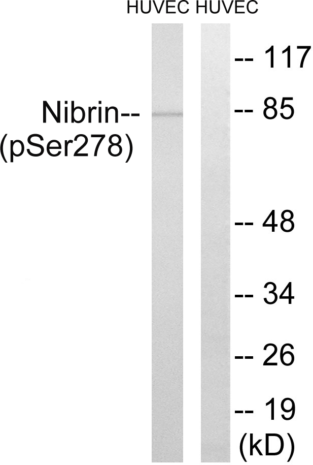 NBN / Nibrin Antibody - Western blot analysis of lysates from HUVEC cells treated with Forskolin 40nM 30', using Nibrin (Phospho-Ser278) Antibody. The lane on the right is blocked with the phospho peptide.