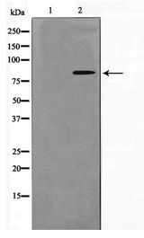 NBN / Nibrin Antibody - Western blot of HUVEC cell lysate using Phospho-Nibrin(Ser278) Antibody