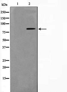 NBN / Nibrin Antibody - Western blot analysis on HuvEc cell lysates using Phospho-Nibrin(Ser278) antibody. The lane on the left is treated with the antigen-specific peptide.