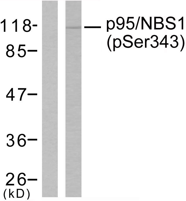 NBN / Nibrin Antibody - Western blot analysis of lysates from Jurkat cells, using p95/NBS1 (Phospho-Ser343) Antibody. The lane on the left is blocked with the phospho peptide.