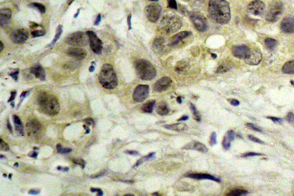 NBN / Nibrin Antibody - IHC of p-p95/NBS1 (S343) pAb in paraffin-embedded human tonsil tissue.