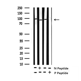 NBN / Nibrin Antibody - Western blot analysis of Phospho-p95/NBS1 (Ser343) expression in various lysates
