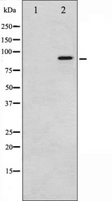 NBN / Nibrin Antibody - Western blot analysis of p95/NBS1 phosphorylation expression in Jurkat whole cells lysates. The lane on the left is treated with the antigen-specific peptide.