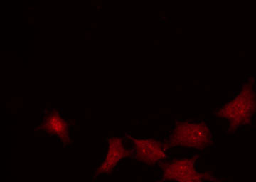 NBN / Nibrin Antibody - Staining HuvEc cells by IF/ICC. The samples were fixed with PFA and permeabilized in 0.1% Triton X-100, then blocked in 10% serum for 45 min at 25°C. The primary antibody was diluted at 1:200 and incubated with the sample for 1 hour at 37°C. An Alexa Fluor 594 conjugated goat anti-rabbit IgG (H+L) Ab, diluted at 1/600, was used as the secondary antibody.