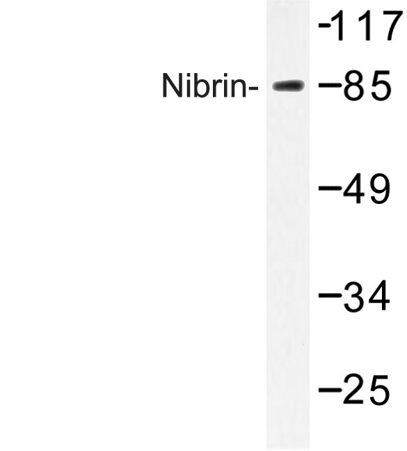 NBN / Nibrin Antibody - Western blot of Nibrin (P461) pAb in extracts from A549 cells.