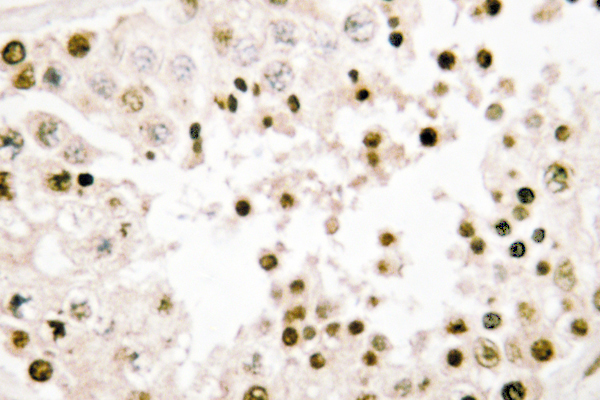 NBN / Nibrin Antibody - IHC of Nibrin (P461) pAb in paraffin-embedded human testis tissue.