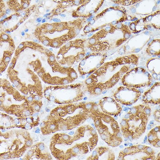 NBP / NUBP1 Antibody - Immunohistochemistry of paraffin-embedded Mouse kidney using NUBP1 Polyclonal Antibody at dilution of 1:100 (40x lens).