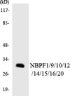 NBPF1+9+10+12+14+15+16+20 Antibody - Western blot analysis of the lysates from HT-29 cells using NBPF1/9/10/12/14/15/16/20 antibody.