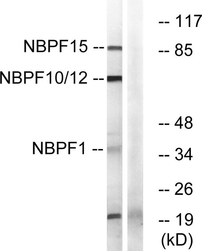 NBPF1+9+10+12+14+15+16+20 Antibody - Western blot analysis of lysates from 293, HepG2, Jurkat, and COLO cells, using NBPF1/9/10/12/14/15/16/20 Antibody. The lane on the right is blocked with the synthesized peptide.