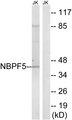 NBPF1+9+10+12+14+15+16+20 Antibody - Western blot analysis of extracts from Jurkat cells, using NBPF5 antibody.