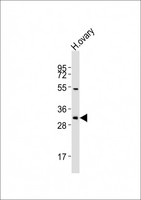 NBPF12 Antibody - Anti-NBPF12 Antibody at 1:2000 dilution + human ovary lysates Lysates/proteins at 20 ug per lane. Secondary Goat Anti-Rabbit IgG, (H+L), Peroxidase conjugated at 1/10000 dilution Predicted band size : 31 kDa Blocking/Dilution buffer: 5% NFDM/TBST.