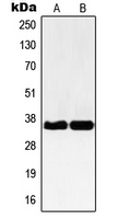 NBPF12 Antibody - Western blot analysis of NBPF-pan expression in Jurkat (A); HEK293 (B) whole cell lysates.