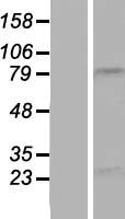 NBPF15 Protein - Western validation with an anti-DDK antibody * L: Control HEK293 lysate R: Over-expression lysate