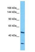 NBPF3 Antibody - NBPF3 antibody Western Blot of Jurkat. Antibody dilution: 1 ug/ml.  This image was taken for the unconjugated form of this product. Other forms have not been tested.