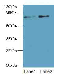 NBPF3 Antibody - Western blot. All lanes: NBPF3 antibody at 1.2 ug/ml. Lane 1: PC-3 whole cell lysate. Lane 2: HT29 whole cell lysate. Secondary Goat polyclonal to Rabbit IgG at 1:10000 dilution. Predicted band size: 73 kDa. Observed band size: 73 kDa.