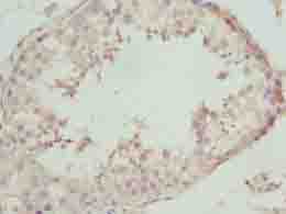 NBPF3 Antibody - Immunohistochemistry of paraffin-embedded human testis tissue using antibody at dilution of 1:100.