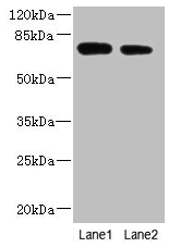NBPF3 Antibody - Western blot All lanes: NBPF3 antibody at 1.2µg/ml Lane 1: PC-3 whole cell lysate Lane 2: HT29 whole cell lysate Secondary Goat polyclonal to rabbit IgG at 1/10000 dilution Predicted band size: 73, 68, 72, 33, 66 kDa Observed band size: 73 kDa