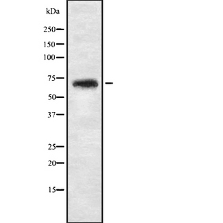NBPF4 Antibody - Western blot analysis of NBPF4 expression in 293T whole cells lysate. The lane on the left is treated with the antigen-specific peptide.