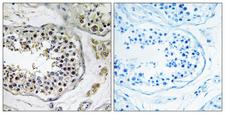 NBPF4 Antibody - Peptide - + Immunohistochemistry analysis of paraffin-embedded human testis tissue using NBPF4 antibody.
