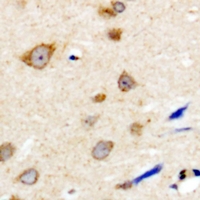 NBPF5P Antibody - Immunohistochemical analysis of NBPF5 staining in human brain formalin fixed paraffin embedded tissue section. The section was pre-treated using heat mediated antigen retrieval with sodium citrate buffer (pH 6.0). The section was then incubated with the antibody at room temperature and detected with HRP and DAB as chromogen. The section was then counterstained with hematoxylin and mounted with DPX.