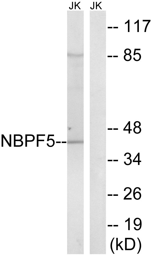 NBPF5P Antibody - Western blot analysis of lysates from Jurkat cells, using NBPF5 Antibody. The lane on the right is blocked with the synthesized peptide.